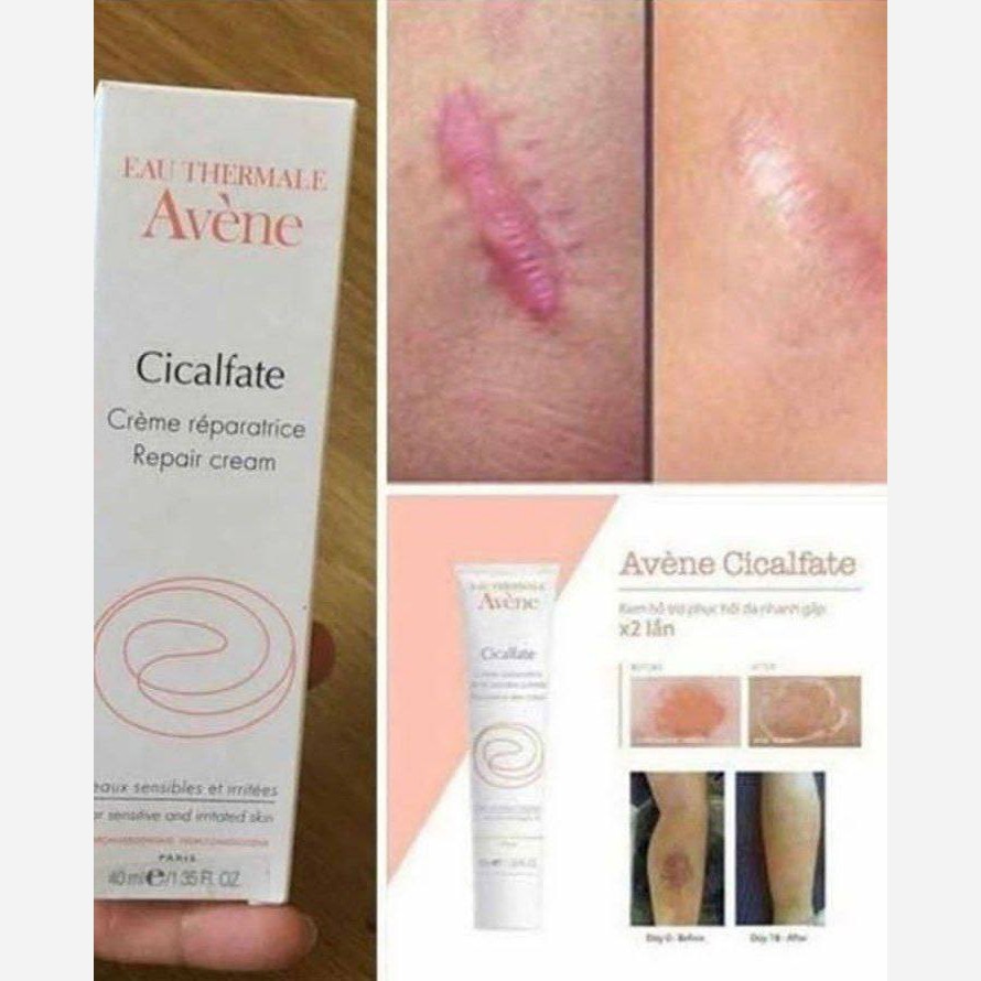 کرم ترمیم کننده سیکالفیت اون Avene Cicalfte+ (مدل جدید مخصوص بخیه)