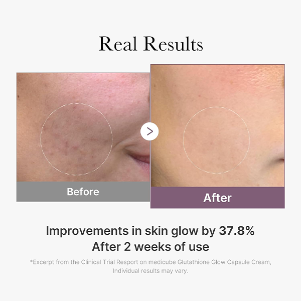 کرم ضد لک و جوانساز گلوتاتیون مدیکیوب مدل AGE-R
