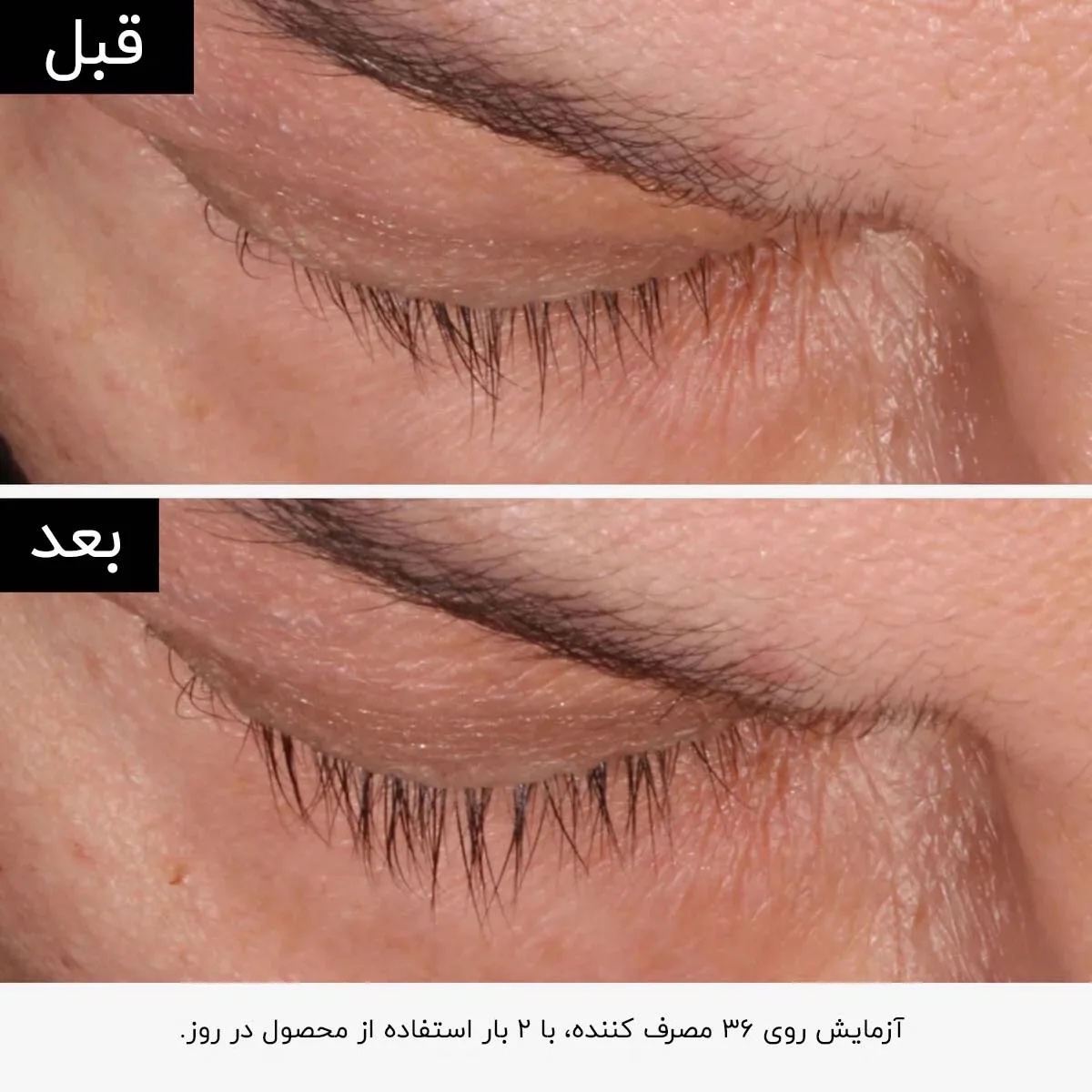 پک دو عددی سرم تقویت کننده مژه و ابرو اوردینری