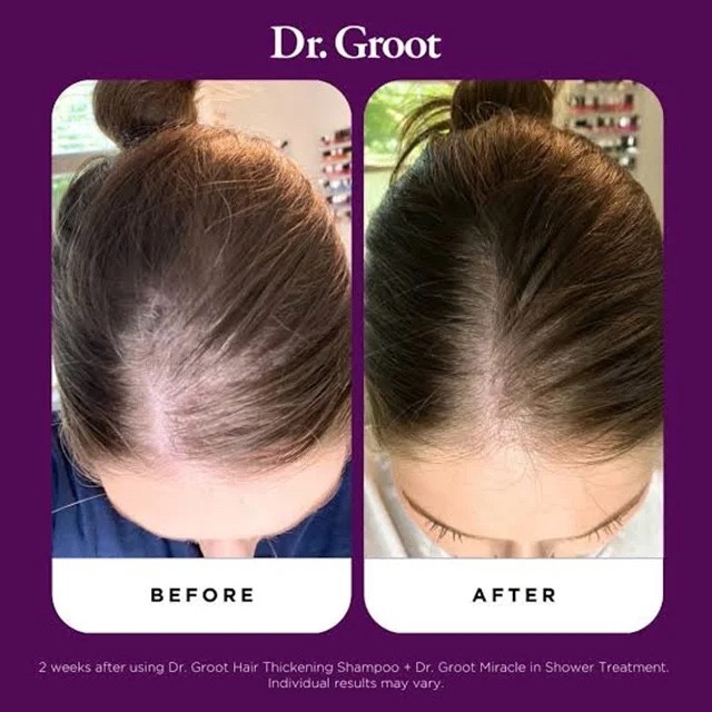 سرم ضد ریزش دکتر گروت Dr.Groot (ضخیمکننده قوی مو)