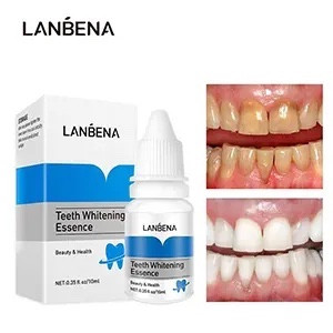 محلول سفید کننده دندان لانبنا LANBENA اورجینال