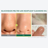 روغن پاک کننده صورت آنوا مدل Heartleaf حجم 200 میلی لیتر